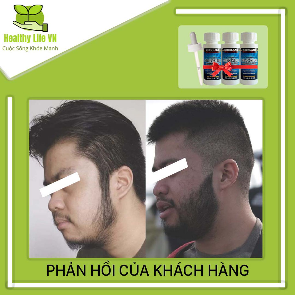 Minoxidil 5% Dạng Lỏng Mọc Râu Tóc Kirkland Mỹ Combo 3 Lọ