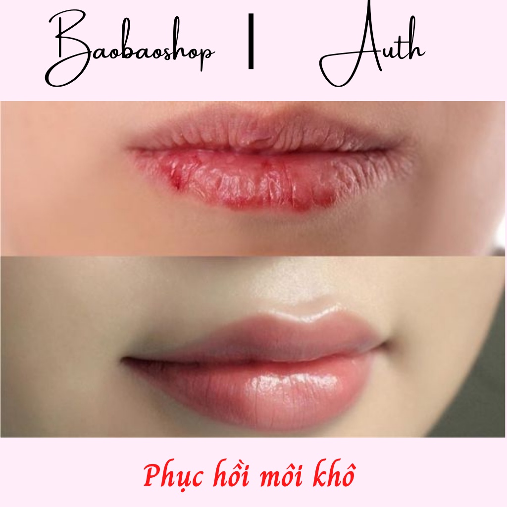 Mặt nạ môi dưỡng thâm, khô giúp căn mọng mềm môi Bioaqua