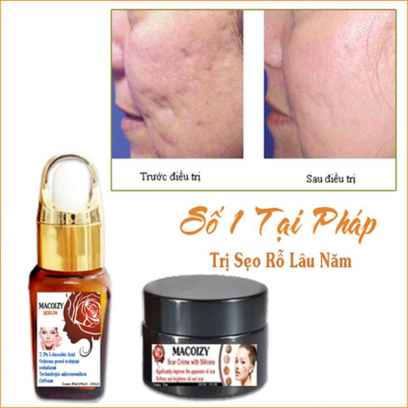 Bộ Serum Kem Xóa Sẹo Rỗ Sẹo Mụn Lâu Năm