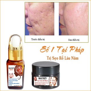 KEM SERUM LÀNH SẸO RỖ SẸO MỤN