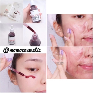 Tinh chất Red Peel Tingle Serum