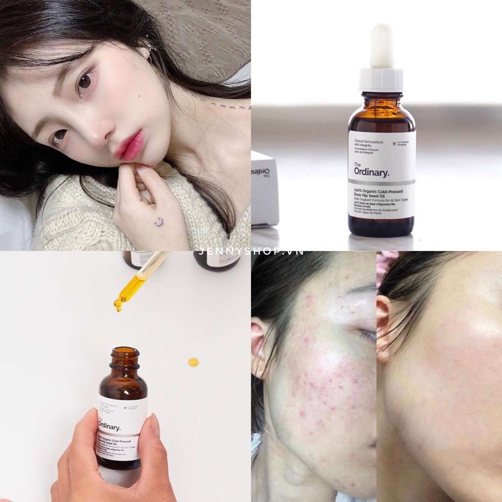 Dầu Dưỡng Da The Ordinary 100% Organic Cold Pressed Rose Hip Seed Oil