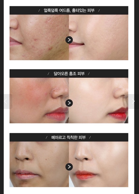 [ order] kem mắt của khách | BigBuy360 - bigbuy360.vn