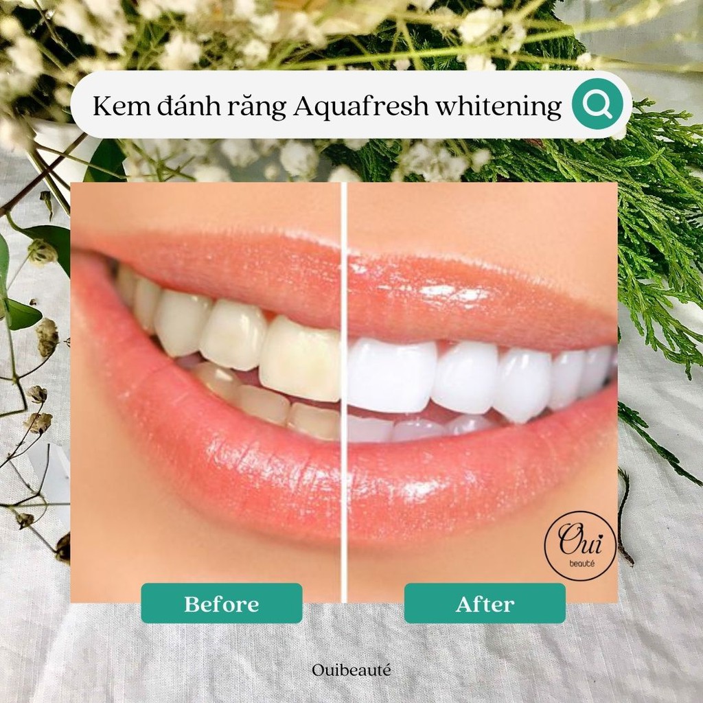 Kem đánh răng Aquafresh Whitening, kem chăm sóc và bảo vệ răng miệng giúp răng trắng sáng 100ml Ouibeaute