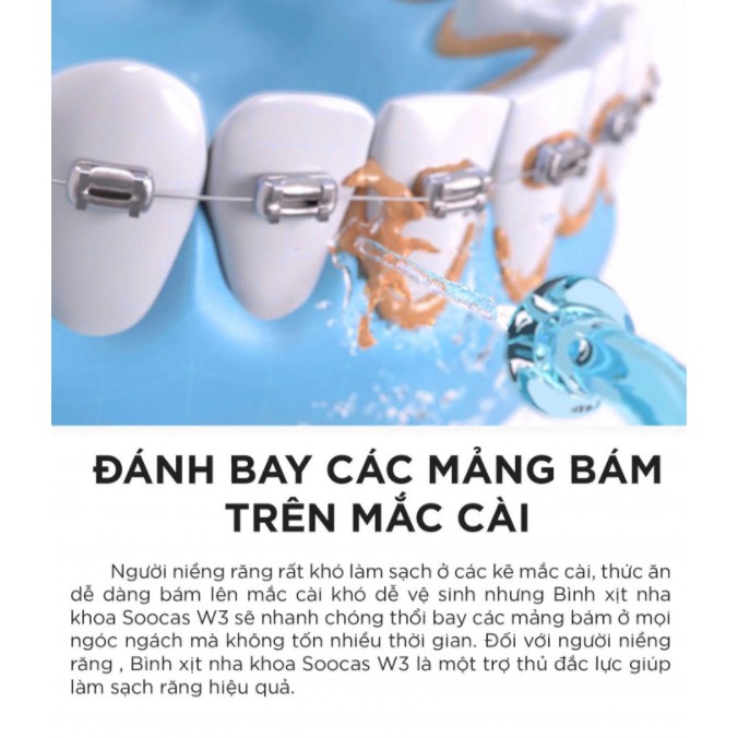 Hoả tốc | Máy tăm nước cầm tay vệ sinh răng miệng XIAOMI SOOCAS W3 bản kèm 4 vòi | W3 PRO | XIAOMI H2OFLOSS | MIHOANGGIA