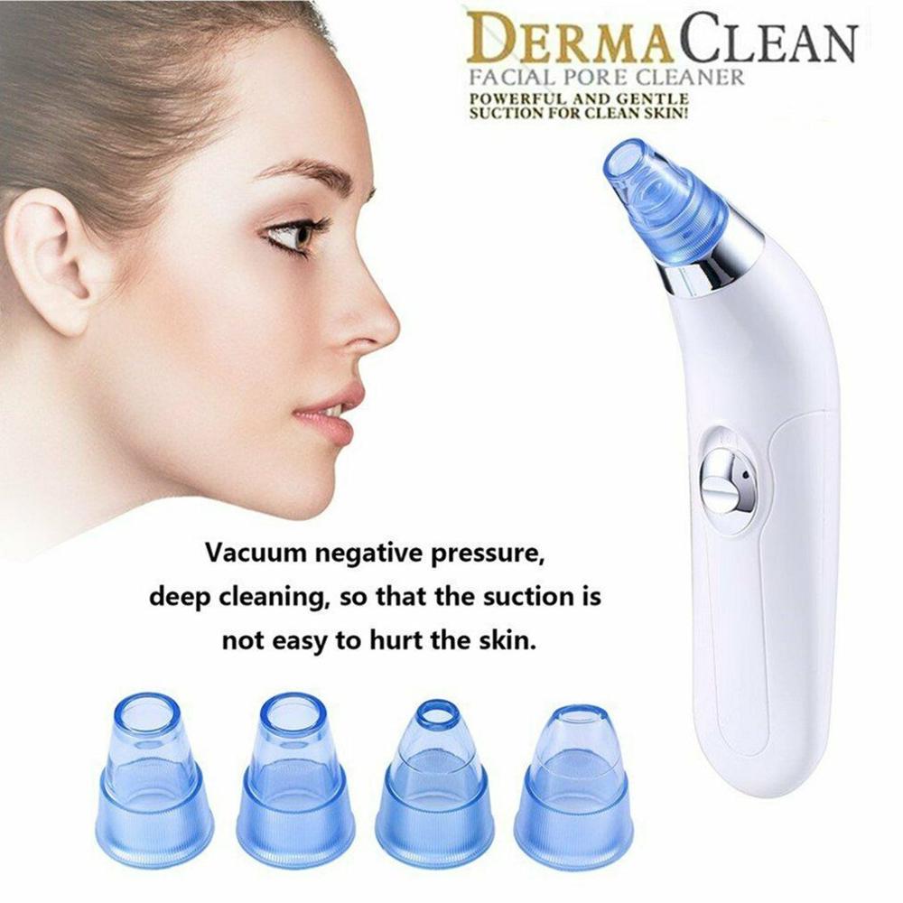 [Hàng mới về] Máy hút mụn đầu đen 4 trong 1 tiện dụng