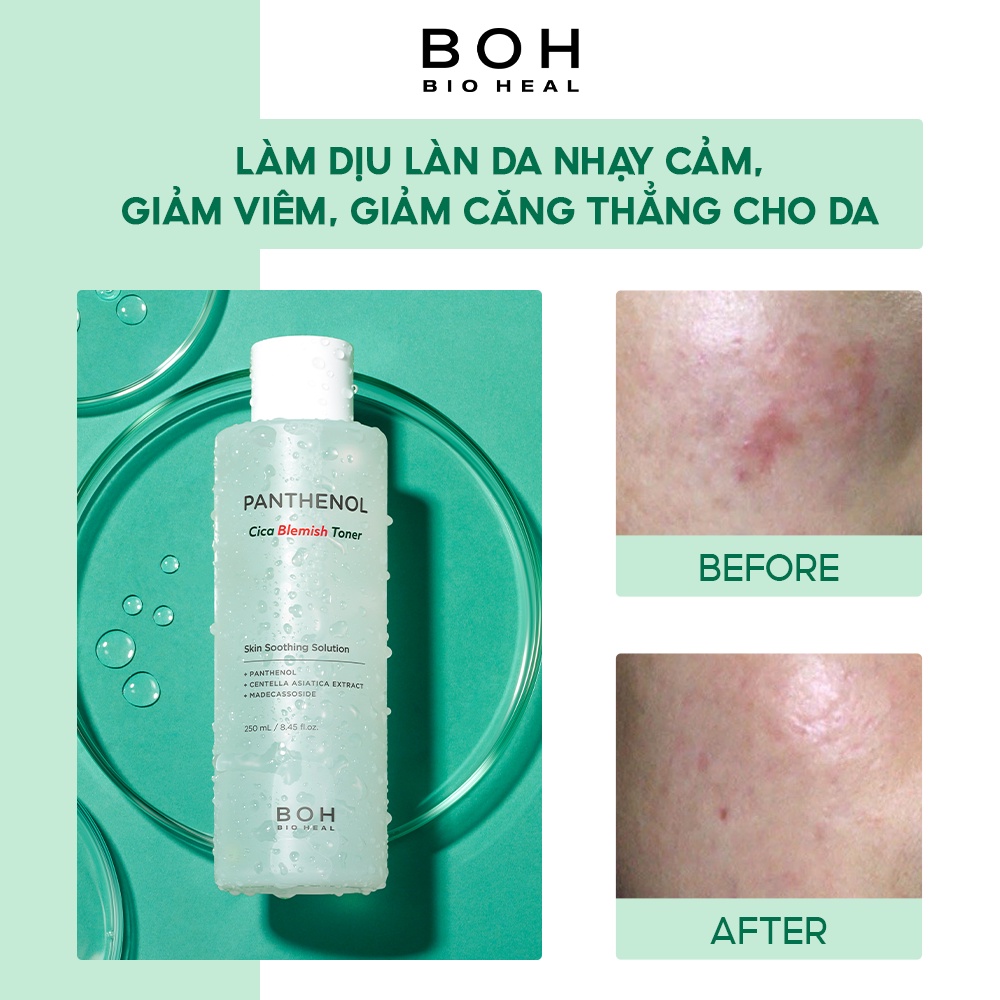 Nước Hoa Hồng Làm Dịu Da Chiết Xuất Rau Má BIOHEAL BOH Panthenol Cica Blemish Toner 250ml