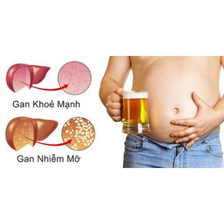 Viên Cà Gai Leo - Mật Nhân DSD