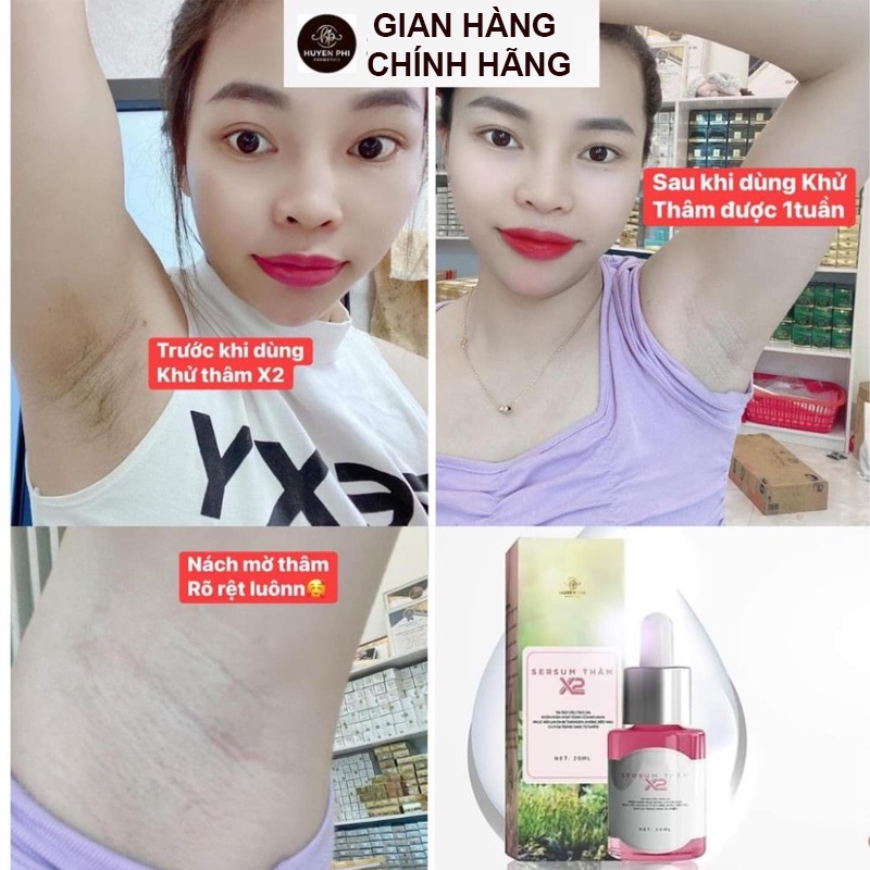 Serum thâm x2 Huyền Phi, xoá vết thâm nách, bụng, tay, chân làm sáng da