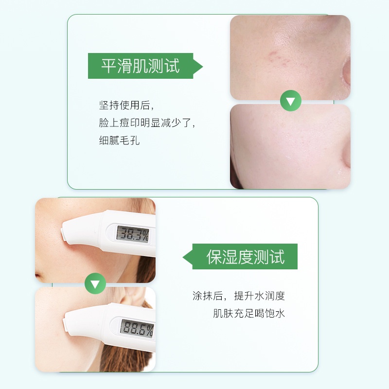 Gel Lô Hội Heyxi Gel Nha Đam Dưỡng Ẩm Ngừa Mụn Thu Nhỏ Lỗ Chân Lông Surica HX02