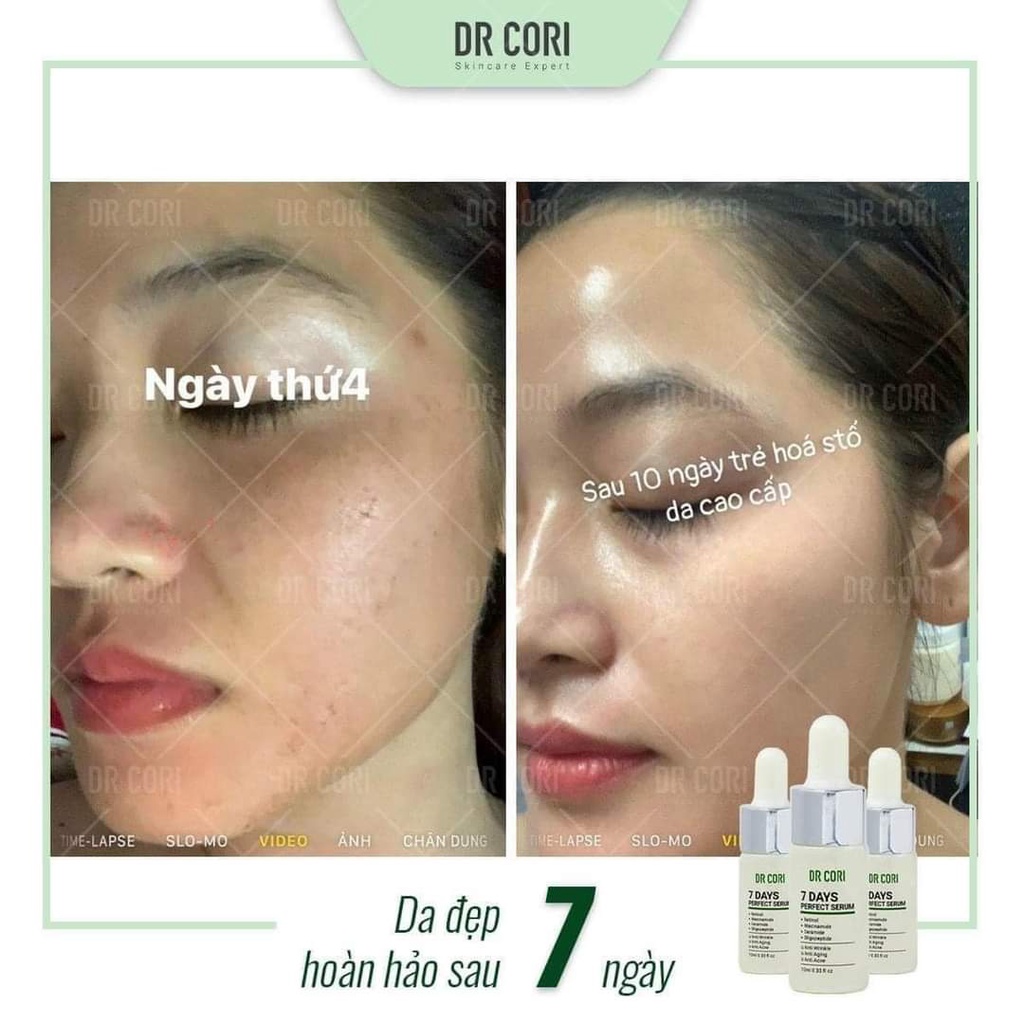 Tinh chất tái tạo Dr Cori 7 days perfect serum 10ml