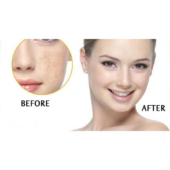 Serum The Ordinary Salicylic Acid 2% Solution. tinh chất tẩy tế bào ra chết, ngăn ngừa mụn | BigBuy360 - bigbuy360.vn