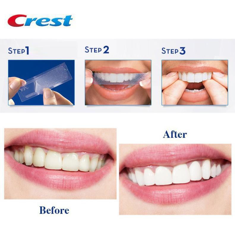 Combo 14 miếng (7 gói/7 ngày) dán trắng răng Crest 3D White Whitestrips loại Professional Effects - Mỹ candaodanfw_27
