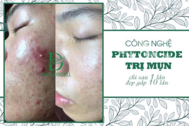 Hộp tế bào gốc mụn Dr pluscell ( CAM KẾT HÀNG CHÍNH HÃNG )