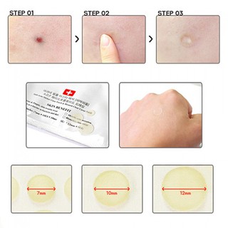 Miếng dán mụn Cosrx Acne Pimple Master Patch Epi Cosmetics