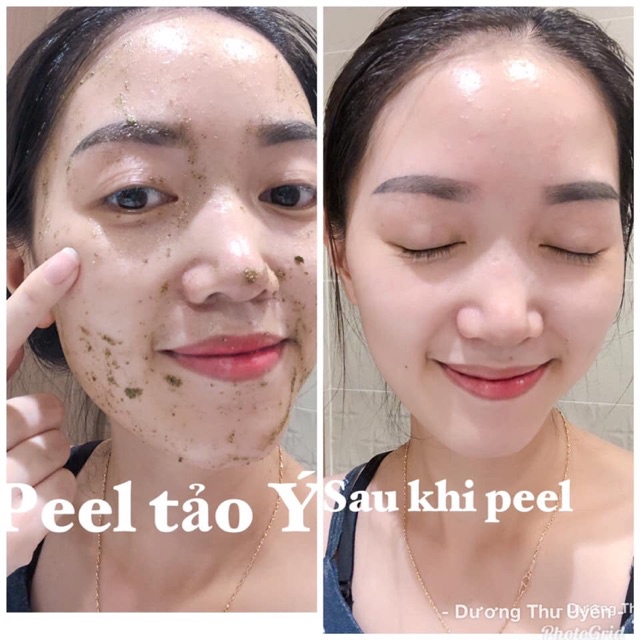 (SET LẺ)Peel da tảo ý căng bóng ,trắng sáng da
