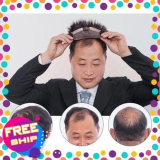 [FLASH SALE]  Tóc giả che hói nam  [SALE 20%]