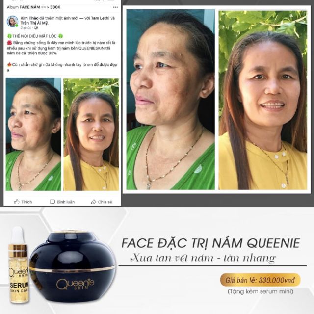 Kem face nám Queenie skin