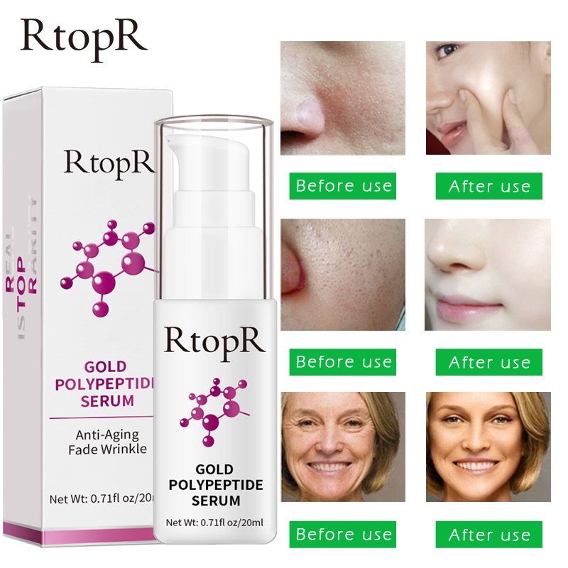 Tinh chất RtopR vàng 24K polypeptide hyaluronic acid dưỡng trắng da chống lão hóa chất lượng cao lỏng giữ ẩm cho mặt Serum làm trắng thực vật chăm sóc da chống nhăn 20ml