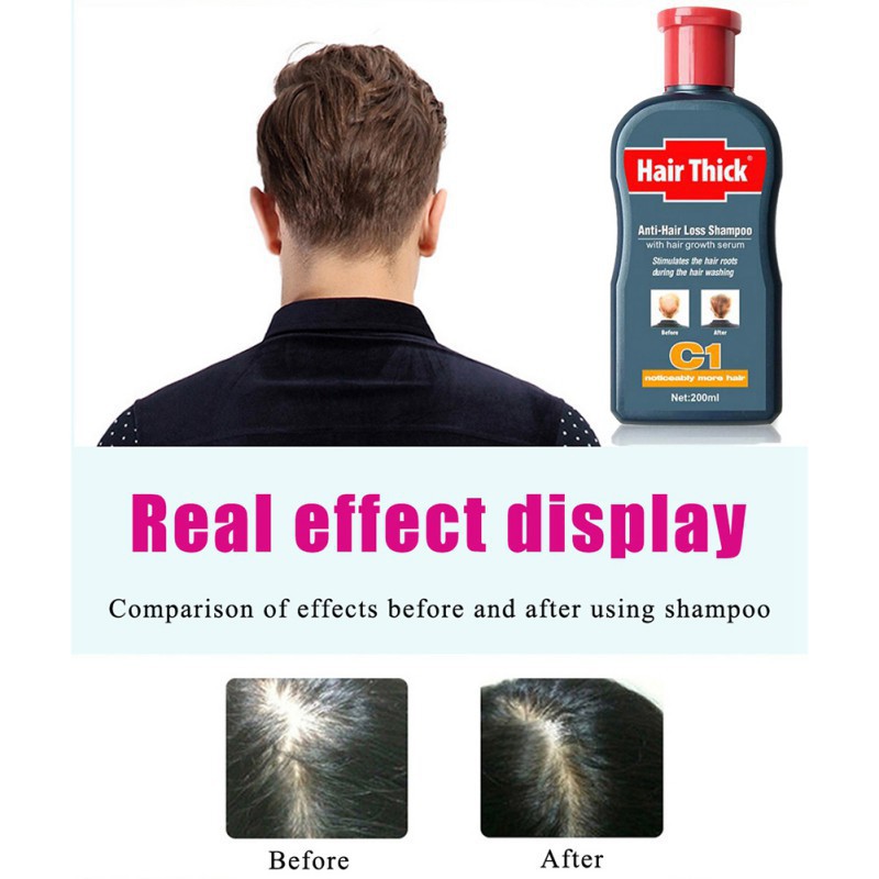 Dầu gội kích thích mọc tóc DEXE 100ml