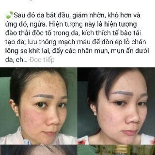 Thuốc bắc thảo dược