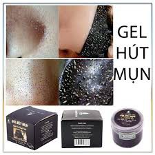 [QUÀ TẶNG] Gel ột mụn than tre hoạt tính Ngân Bình hộp 50g