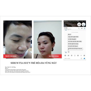 Tinh chất Trẻ hóa da vùng mắt
