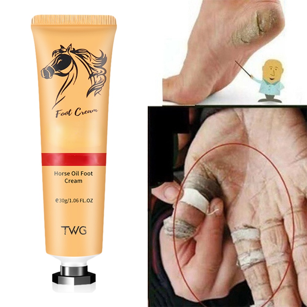 Kem Dưỡng Ẩm Da Chân Chống Nứt Nẻ Dành Cho Đi Du Lịch Ngoài Trời