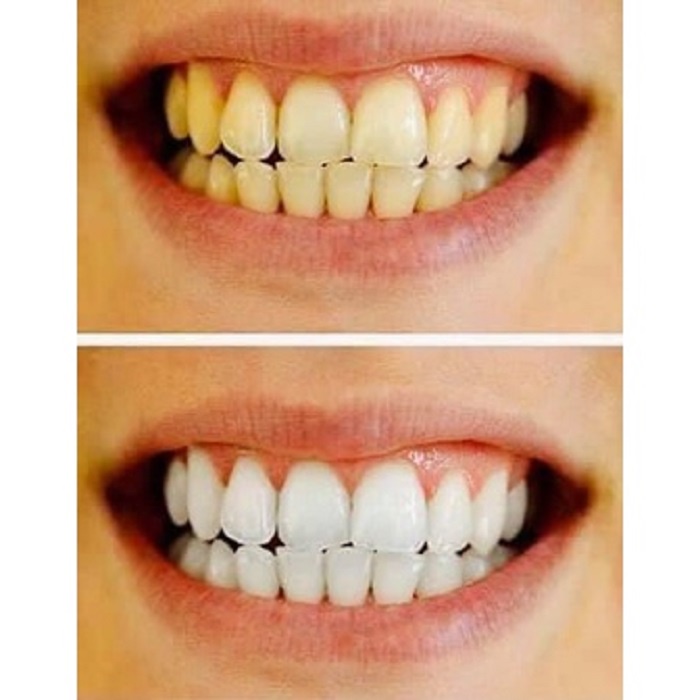 Kem Đánh Răng Cho Răng Trắng Sáng Gấp 3 lần Crest 3D White Advanced Triple Whitening 158g - Hàng Mỹ