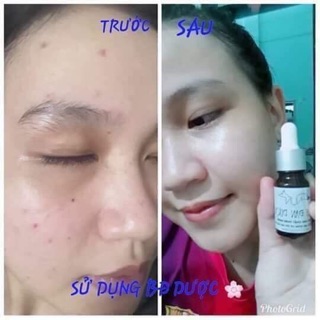 Serum Bạch Đan Dược
