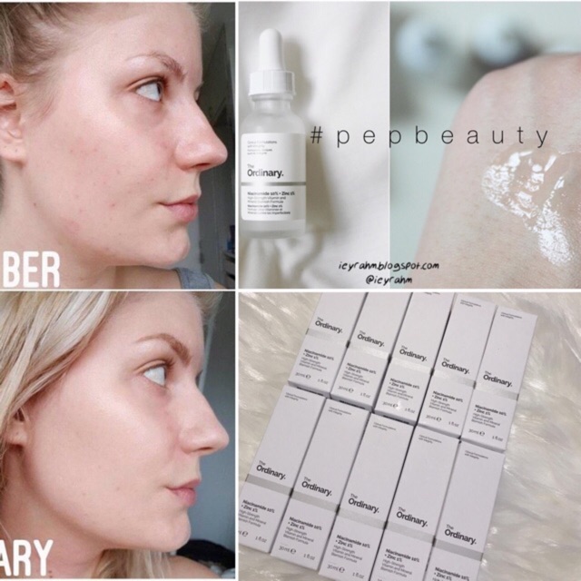 [AUTH BILL MỸ] Tinh chất dưỡng da The Ordinary Niacinamide 10% + Zinc 1% | BigBuy360 - bigbuy360.vn