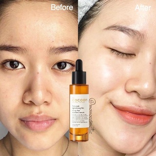 Tinh chất nghệ Hưng Yên Cocoon