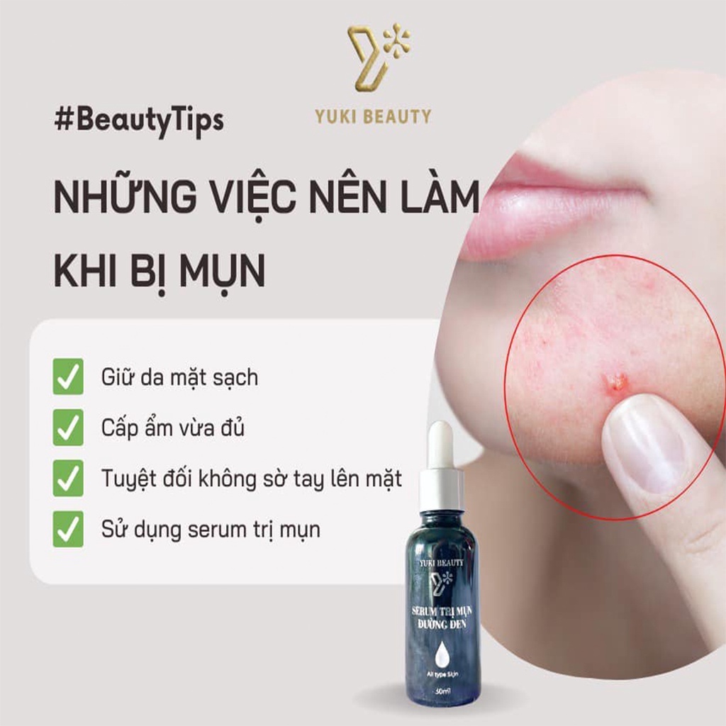 Serum đường đen amanda YUKI BEAUTY ngăn ngừa mụn, serum giảm mụn cho da dầu