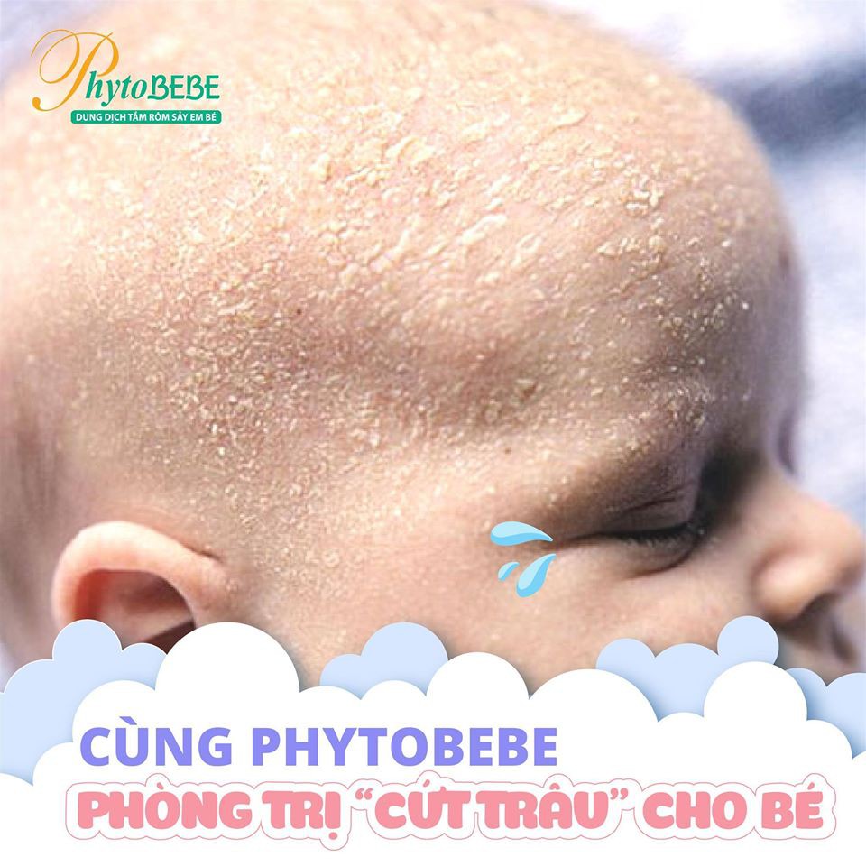 Sữa tắm PhytoBEBE chống rôm sảy em bé 100ml