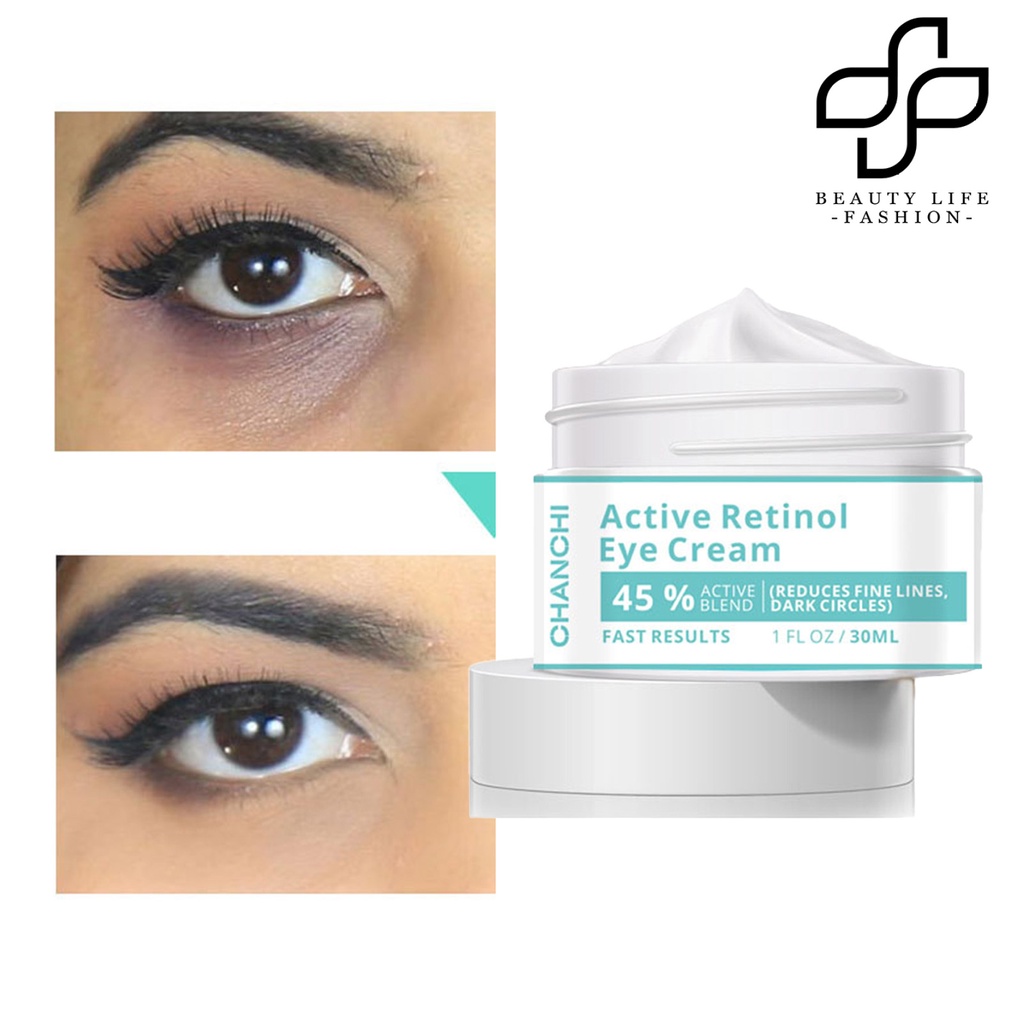 [Hàng mới về] Kem dưỡng da mắt retinol làm sáng da chăm sóc loại bỏ bọng mắt hiệu quả nhanh chóng