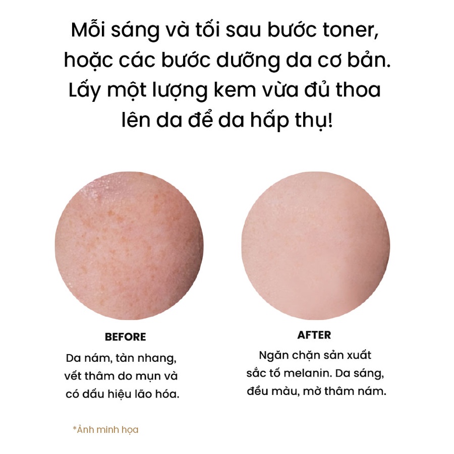 [WHISIS Cao Cấp] Kem Phức Hợp Dưỡng Trắng Da Mờ Thâm Nám Tàn Nhang WHISIS Premium MELASMA Care Complex Cream 50g