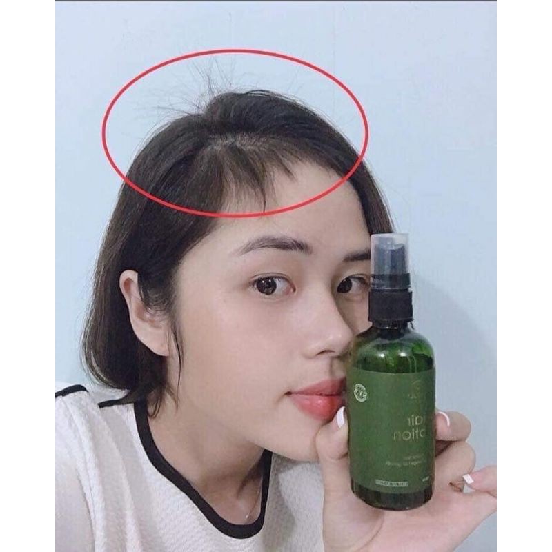 TINH DẦU BƯỞI VIJULLY 100% NGUYÊN CHẤT. | BigBuy360 - bigbuy360.vn