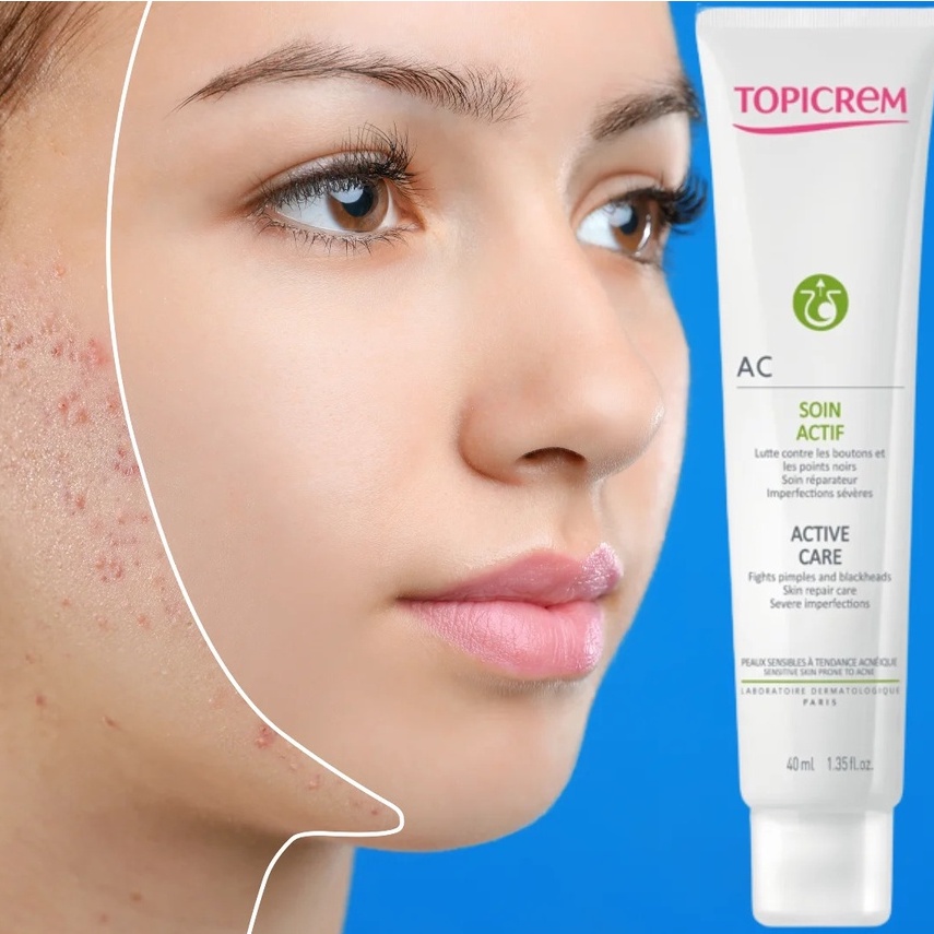Kem dưỡng TOPICREM AC Active Care  giảm mụn cho da dầu mụn