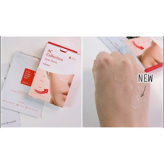 MIẾNG DÁN MỤN COSRX ACNE PIMPLE MASTER PATCH