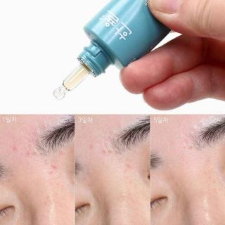 gel chấm mụn Hanyul Hàn Quốc