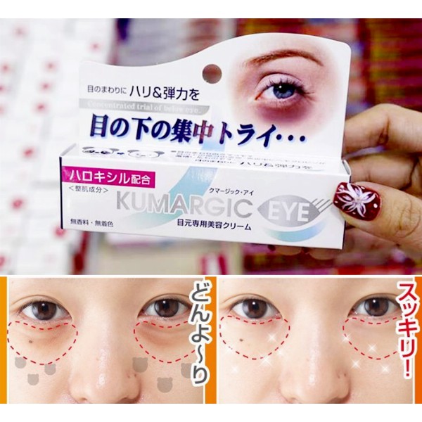 Kem Làm giảm thâm quầng mắt Kumargic Eyes Nhật Bản