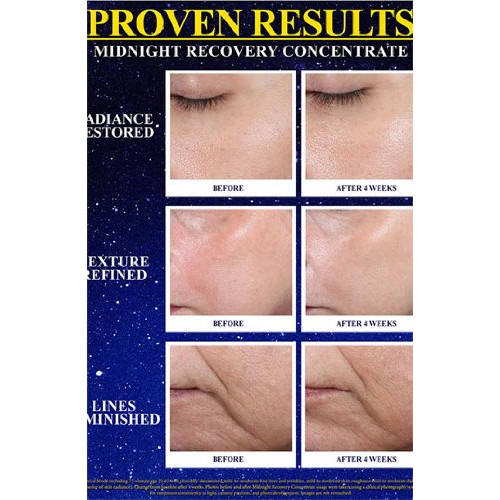 Kiehl's - Minisize - Dầu Dưỡng Da Ban Đêm Kiehl’s Midnight Recovery Concentrate 4ml