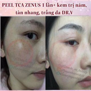 Kem Dưỡng Da Hàn Quốc DR.V