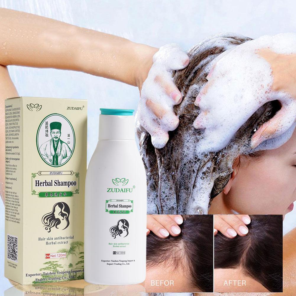 Dầu Gội Đầu Zudaifu Haar Psoriasis 120Ml Tách Biệt Keratin Doos Kruiden P0Z9