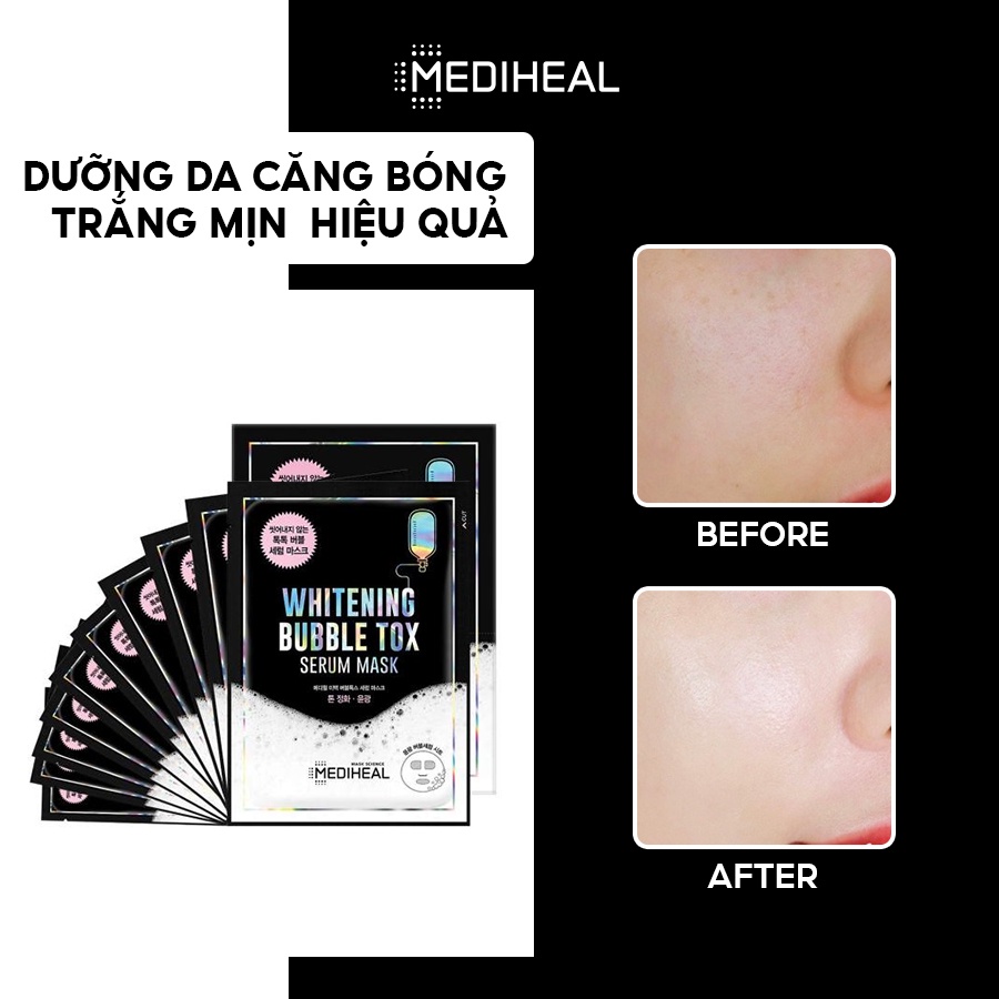 [Nhập mã COSMH22 giảm 8%] Mặt Nạ Thải Độc Mediheal Whitening Bubble Tox Serum Mask 25ml [K59]