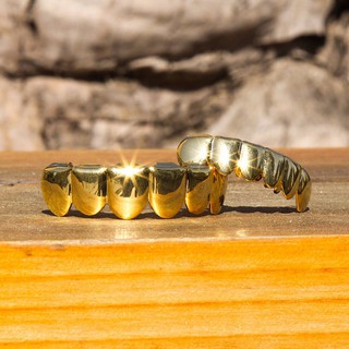 Bộ niềng răng mạ vàng 14K độc lạ