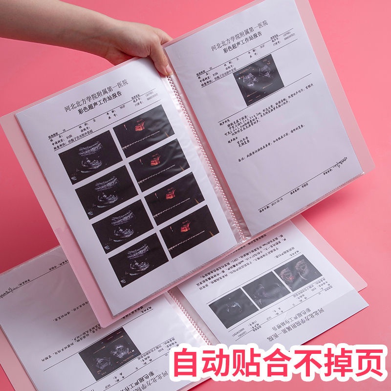 Tập Tin Sôi。Tập Sách Lưu Trữ。 Sổ Tay Kiểm Tra Thai Sản Sản Phẩm Dễ Thương Cho Phụ Nữ Mang Thai B ultrasound thông tin A4