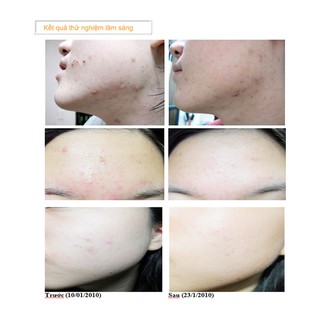 Sữa rửa mặt SNP ACSYS Cleansing Foam 150ml