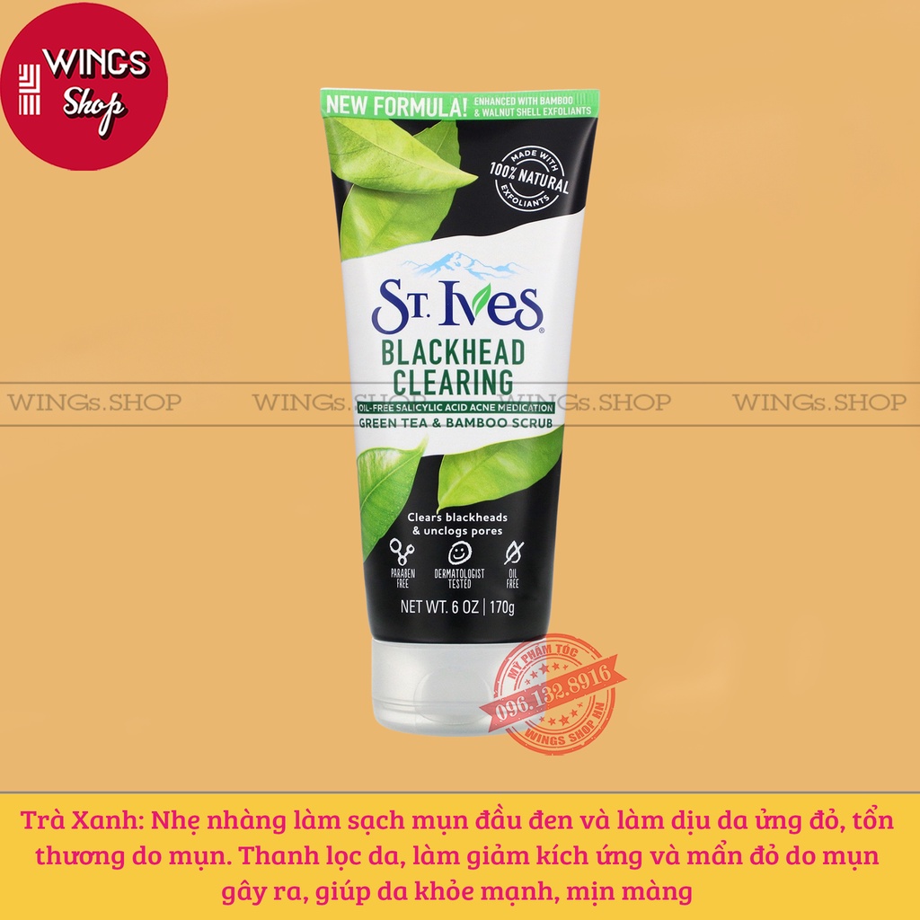 Sữa Rửa Mặt Tẩy Tế Bào Da Chết St.Ives 170g