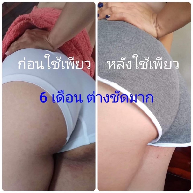 Kem trắng nách Pure Thái Lan